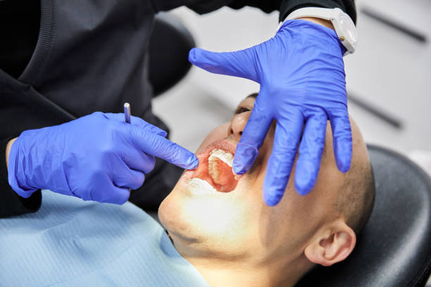 Best Emergency Broken Tooth Repair in Beattyville, KY